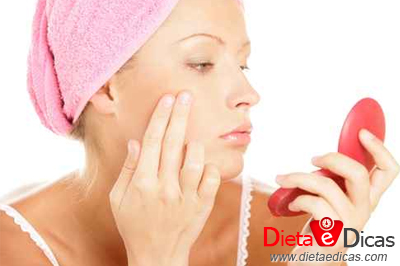 Ilustração de acne tratamento natural, acne o que causa, acne como evitar, acne como tratar, acne e banho de sol, acne o que usar