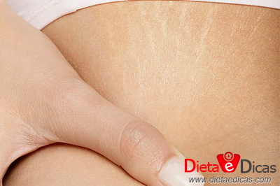 creme caseiro para estrias, receita de creme caseiro para estrias, creme caseiro para estrias na gravidez Ilustração de creme caseiro para estrias, receita de creme caseiro para estrias, creme caseiro para estrias na gravidez